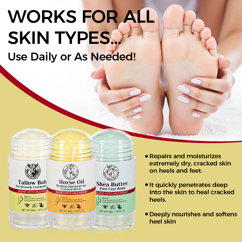 Beeswax Dead Skin Foot Callus Remover Foot Cream Care Stick Cracked Heel Repair Whipped Beef Tallow for Dry Feet - 7